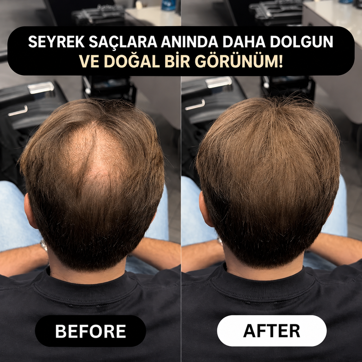 VERONNI™ Hairline Powder – Saç Dolgunlaştırıcı Fiber Tozu