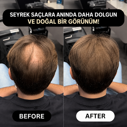 VERONNI™ Hairline Powder – Saç Dolgunlaştırıcı Fiber Tozu