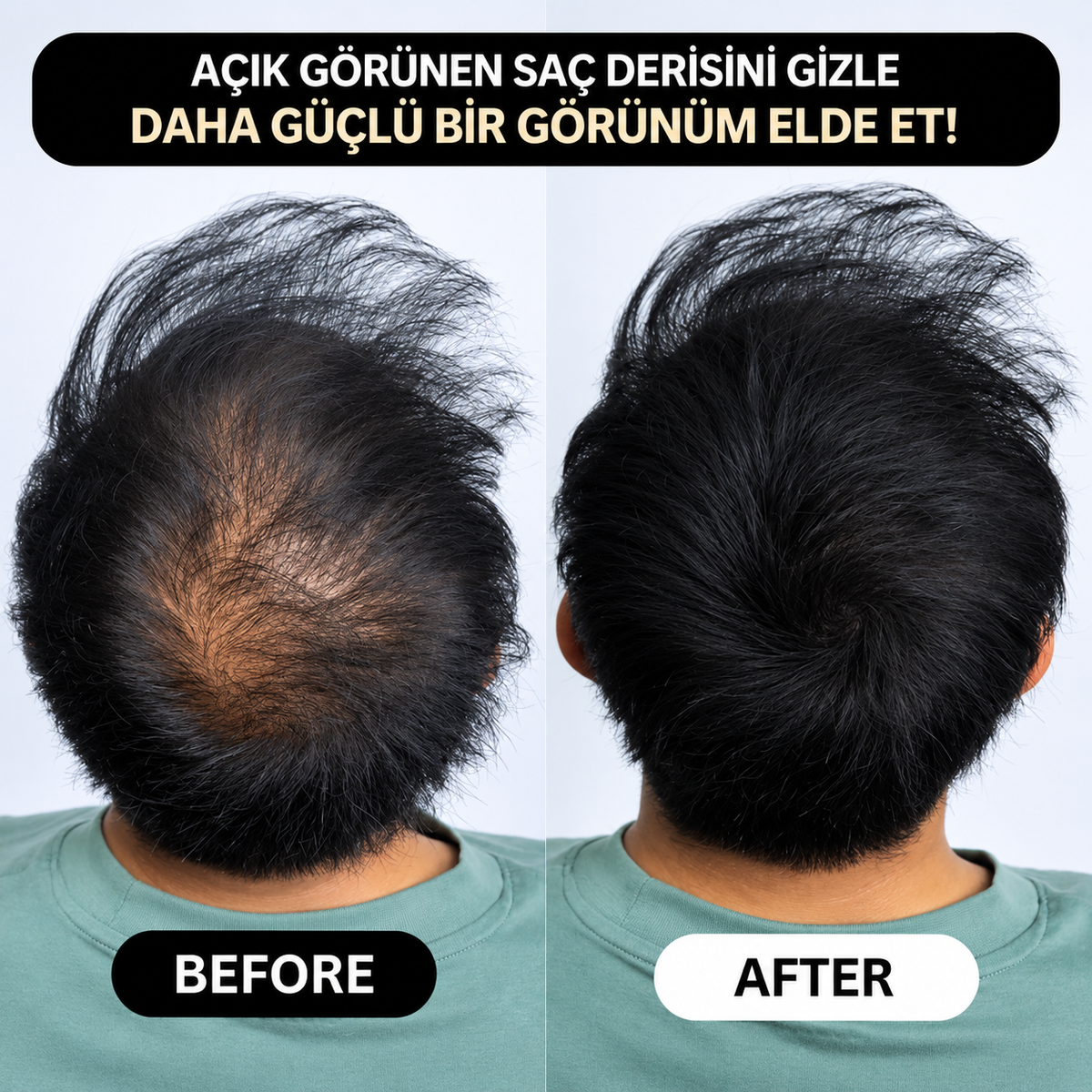 VERONNI™ Hairline Powder – Saç Dolgunlaştırıcı Fiber Tozu