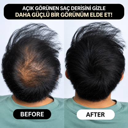 VERONNI™ Hairline Powder – Saç Dolgunlaştırıcı Fiber Tozu