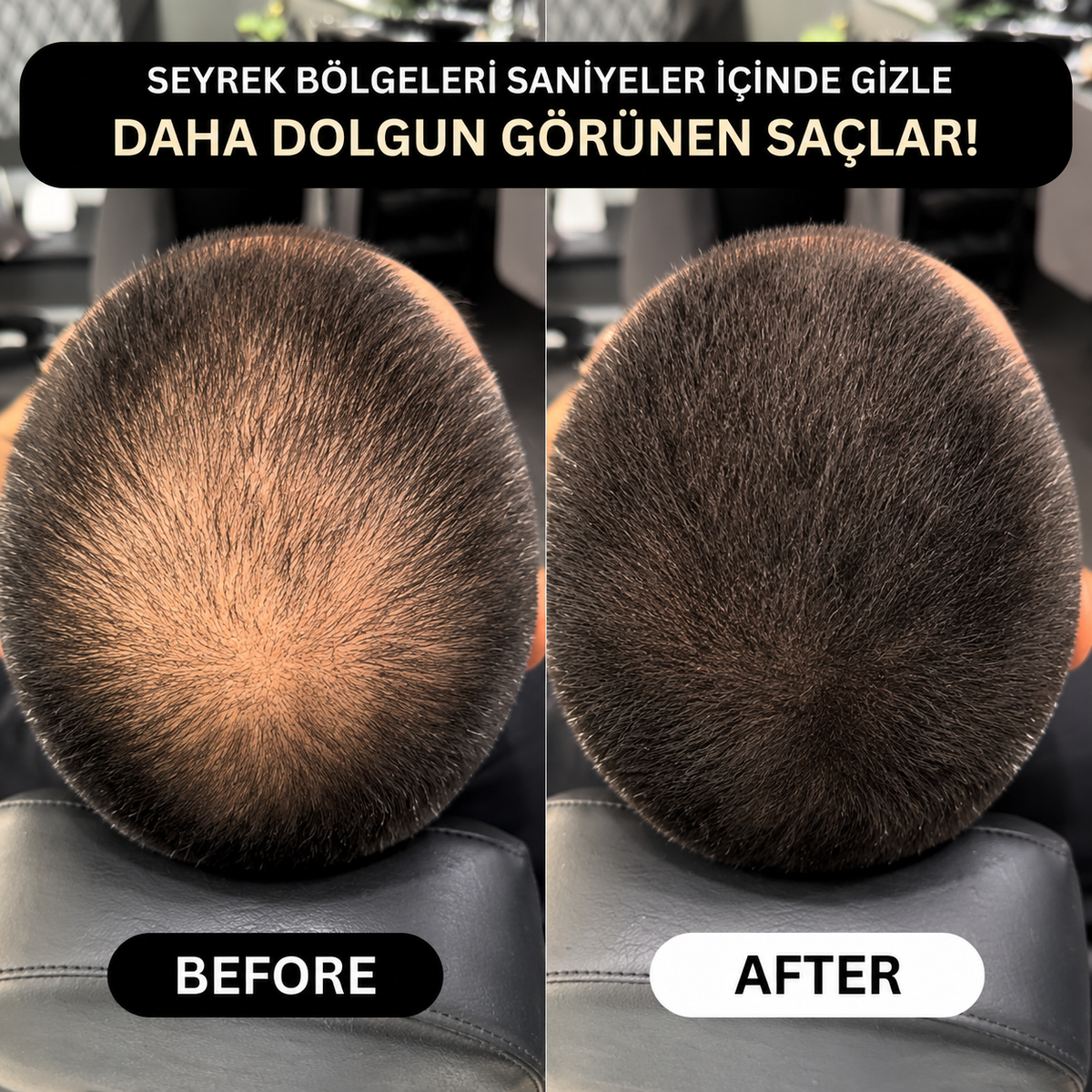 VERONNI™ Hairline Powder – Saç Dolgunlaştırıcı Fiber Tozu