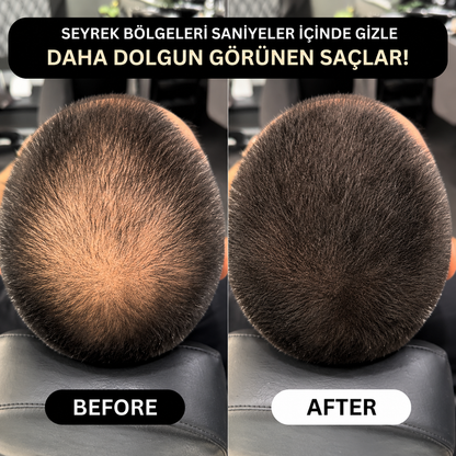 VERONNI™ Hairline Powder – Saç Dolgunlaştırıcı Fiber Tozu